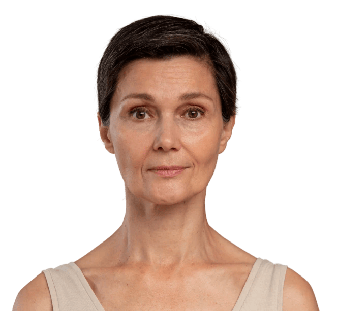 Rejuvenecimiento facial Tenerife