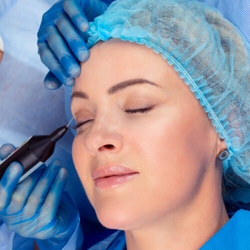 Qué la blefaroplastia con láser PLEXR de Clínica Fortuny en la isla de Tenerife