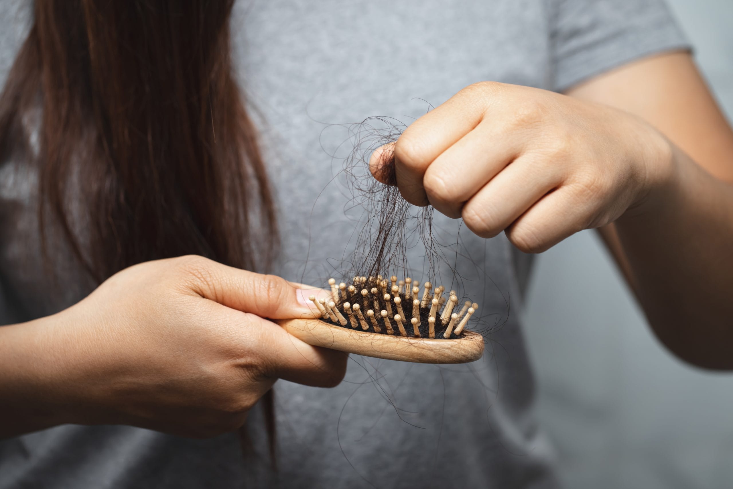 Alopecia no cicatricial
