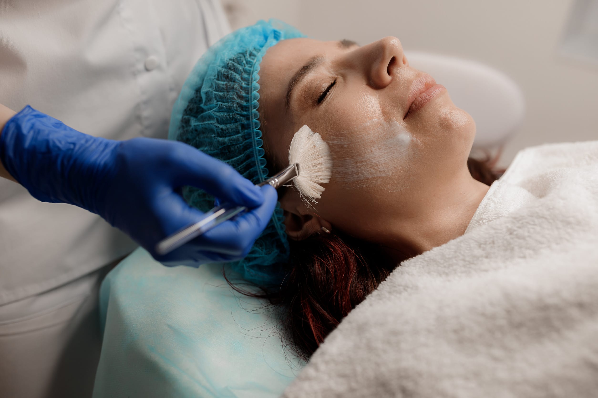 Tipos de peeling qu&iacute;mico